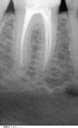 Endodontie1