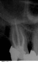 Endodontie2