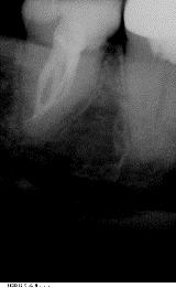 Endodontie3