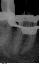 Endodontie4