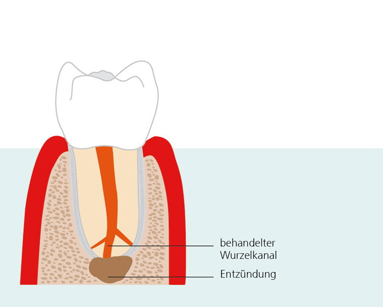 endodontische-chirurgie-1